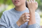 Cara Mencegah dan Penanganan Gatal Karena Alergi